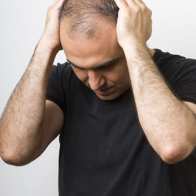 What Happens If a Hair Transplant Goes Wrong