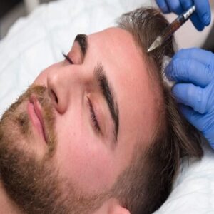 What Are the Benefits of PRP Hair Treatment