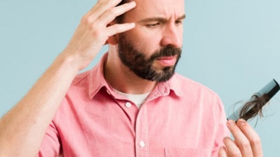 Best Dermatologist for Hair loss in Islamabad