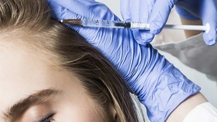 Does PRP Treatment for Hair Loss Work?