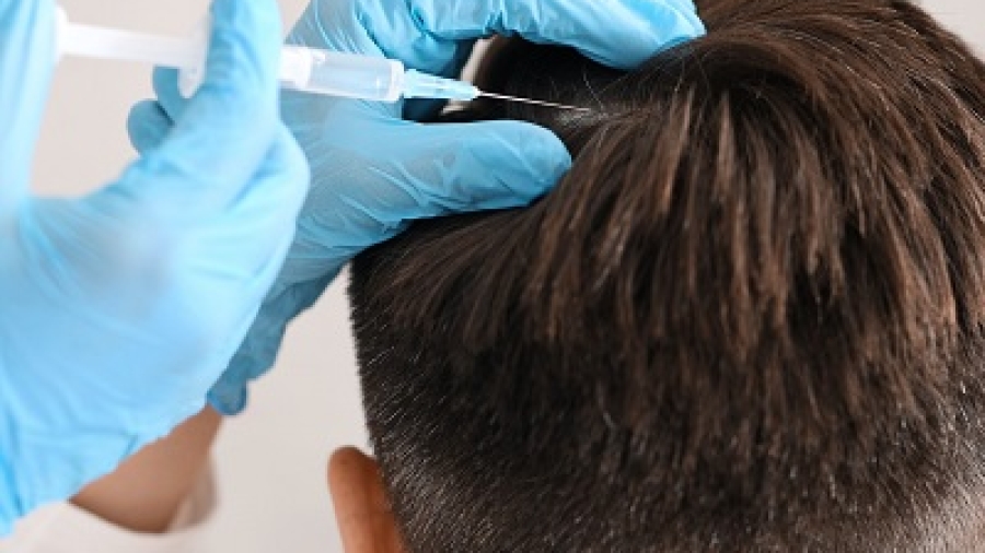 How much time is involved for PRP treatment