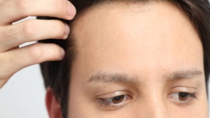 5 Tips for a Successful Hair Restoration Journey in Islamabad