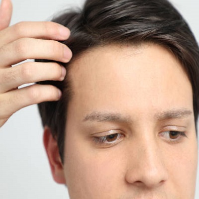5 Tips for a Successful Hair Restoration Journey in Islamabad