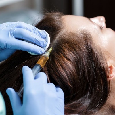 Will PRP hair treatment make me look younger