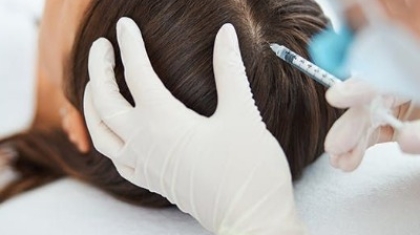 Does PRP hair treatment have any side effects?