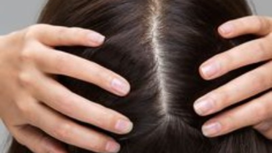 hair loss treatment in Islamabad