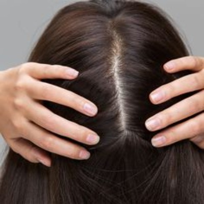 hair loss treatment in Islamabad