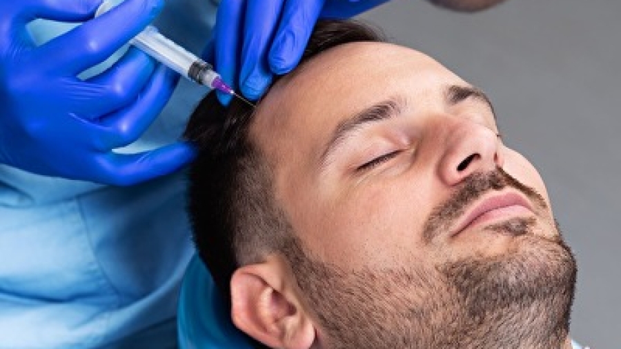 Are 3 Sessions of PRP Hair Treatment Enough