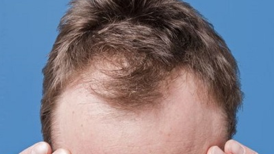 Best Hair Transplant Surgeon Experience vs. Technology