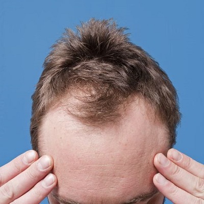 Best Hair Transplant Surgeon Experience vs. Technology