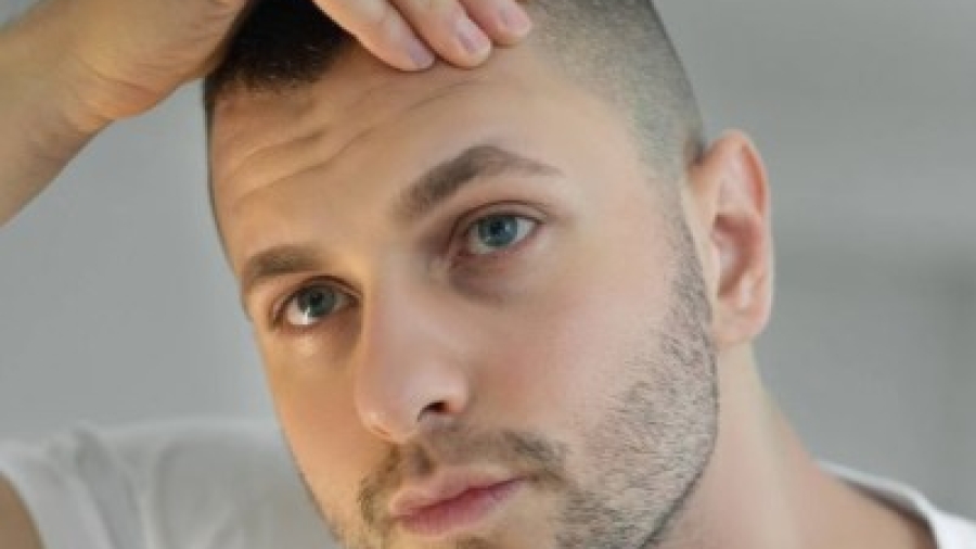 How Does Hair Restoration Compare to Wearing Wigs or Hairpieces