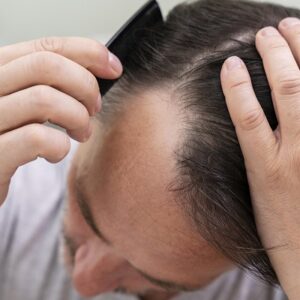 Do hair transplants look natural