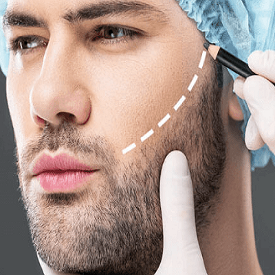 Is beard hair transplant effective and safe