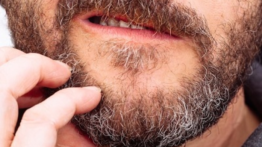 Beard Hair Transplant Near Me