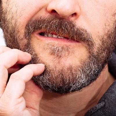 Beard Hair Transplant Near Me