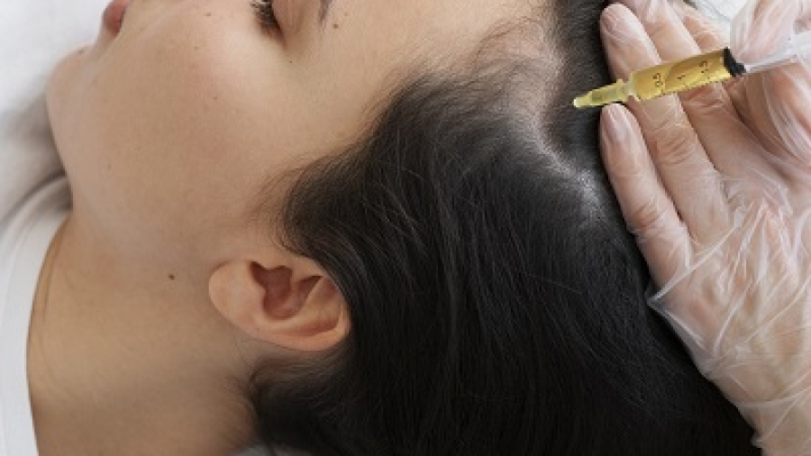 Exosome Hair Therapy vs PRP