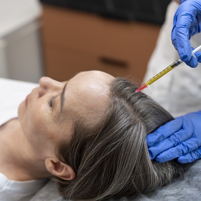 Exosomes Hair Therapy