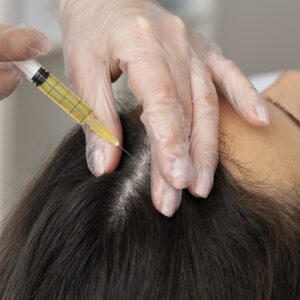 Hair PRP in Islamabad