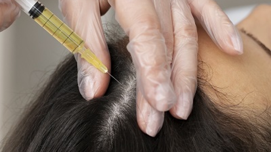 Hair PRP in Islamabad