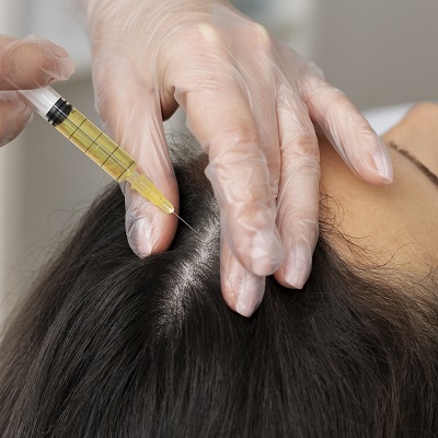Hair PRP in Islamabad