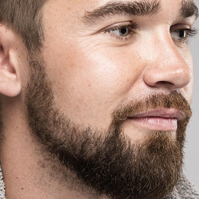 What is the Beard Hair Transplant Success Rate
