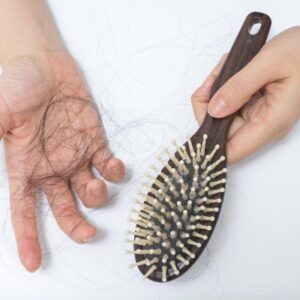 Can Hair Loss Be Reversed Without Surgery in Islamabad