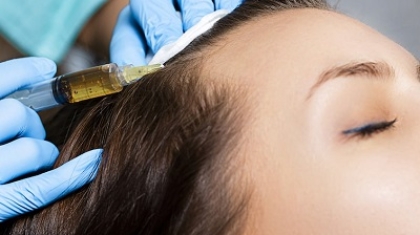 What is hair restoration?