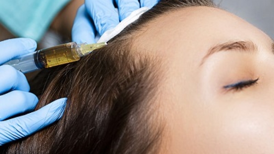 What is hair restoration?