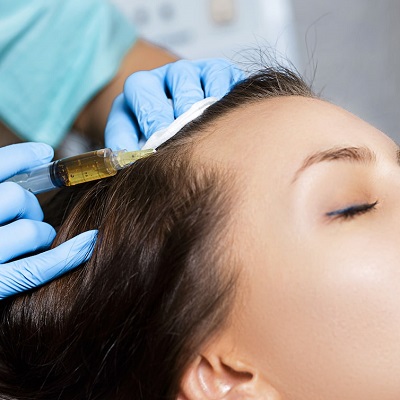 What is hair restoration?