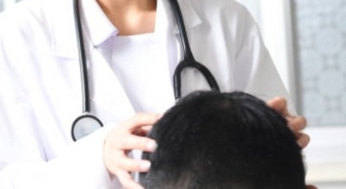 Is Hair Transplant a One-Time Procedure?