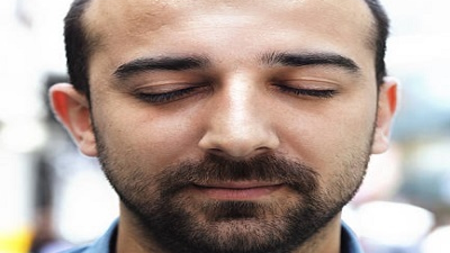 Can Hair Transplant Improve Facial Appearance