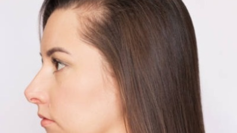 From Thin to Thick: Hair Transformation