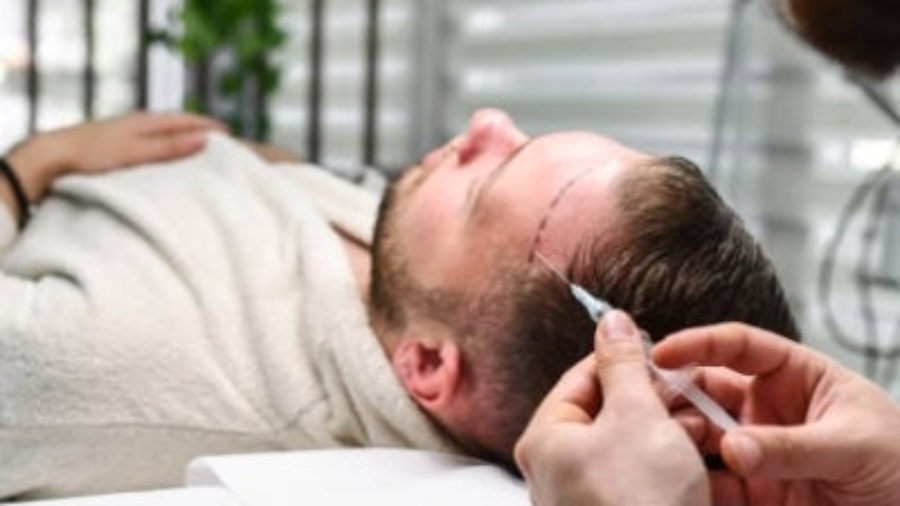 Is Hair Transplant Right for Young Adults