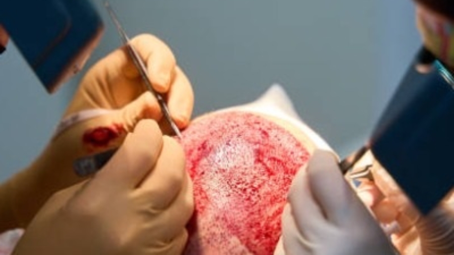 The Smart Way to Restore Your Hair