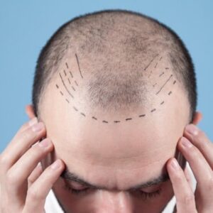 Does the Clinic Provide Patch Tests for Sensitive Scalps