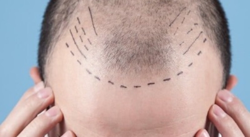 Does the Clinic Provide Patch Tests for Sensitive Scalps