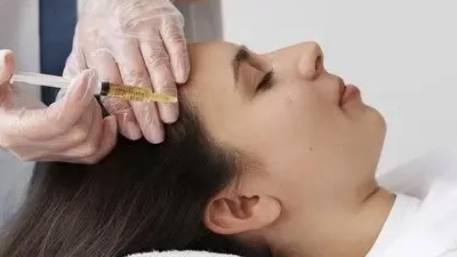 Exosome Injections for Hair in Islamabad