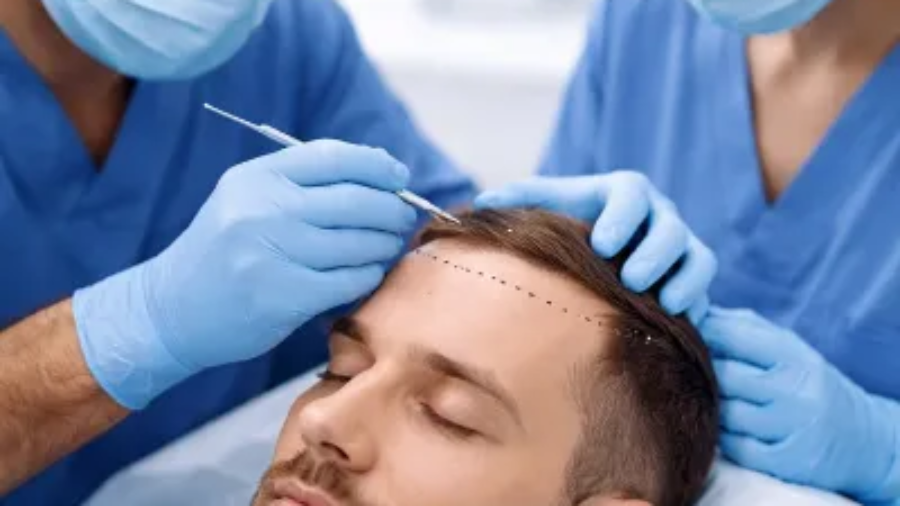Is Hair Transplant Safe in Pakistan