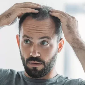 Is Summer the Best Time for Exosome Hair Therapy