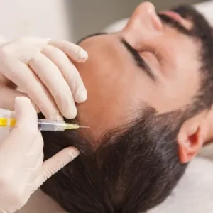 PRP Therapy for Men Experiencing Hair Loss in Islamabad